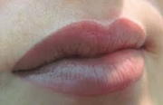губы перед коррекцией